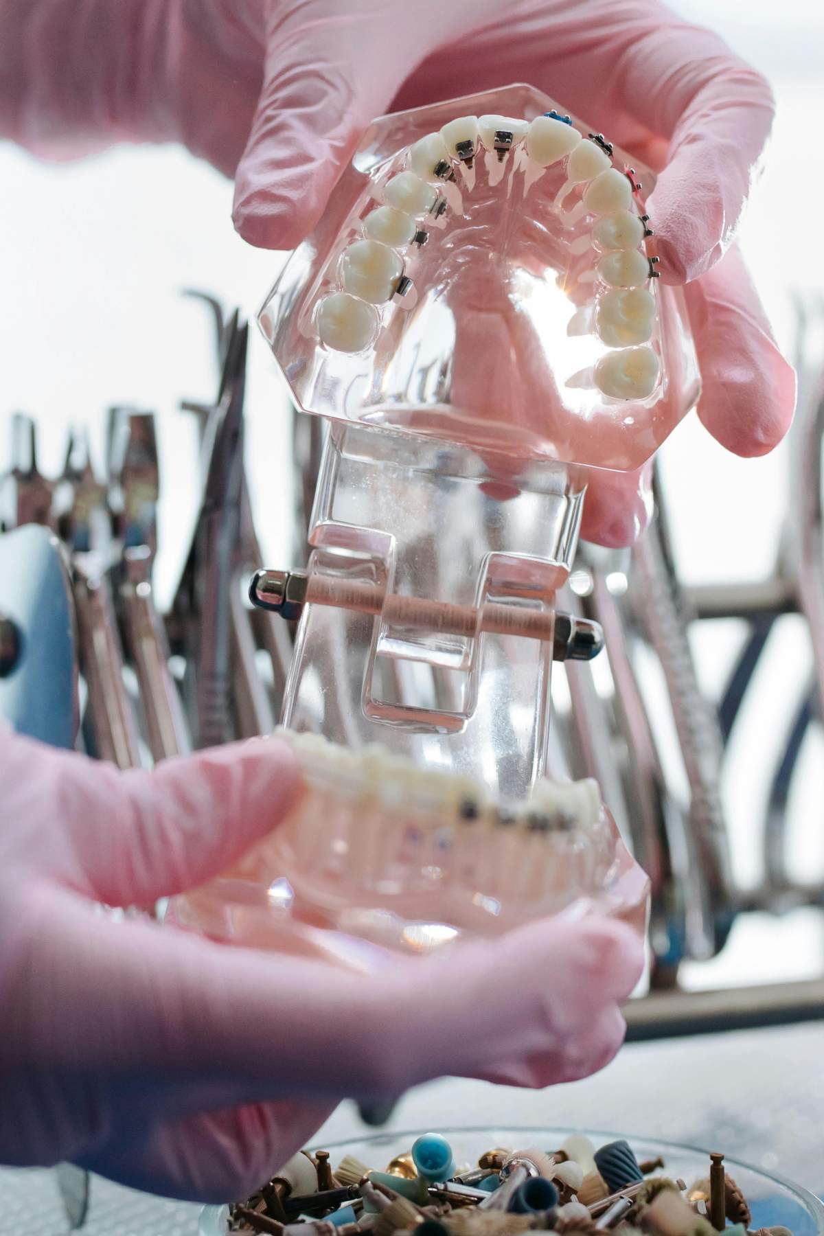 Assessment of Third Molar Surgery
